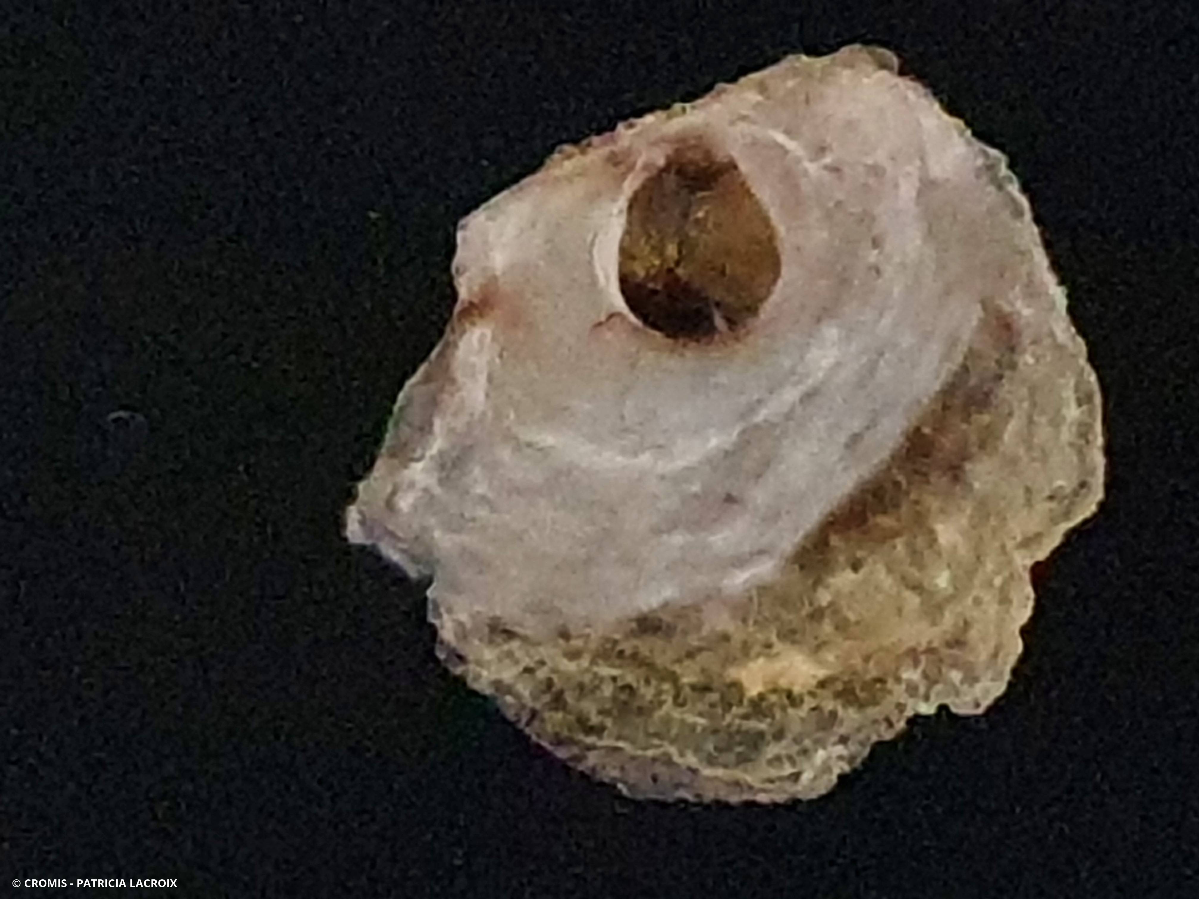 Anomie pelure d'oignon